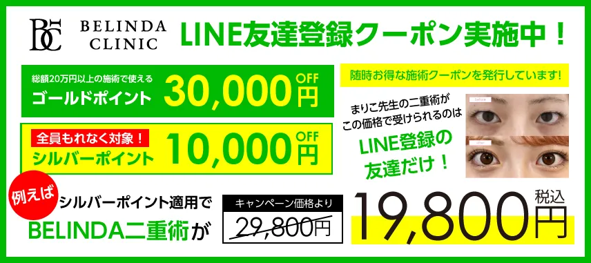 LINEお友達登録で30000円クーポン