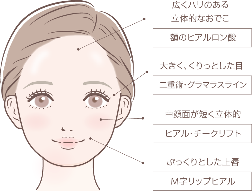 バブみ顔ヒアル注入部位