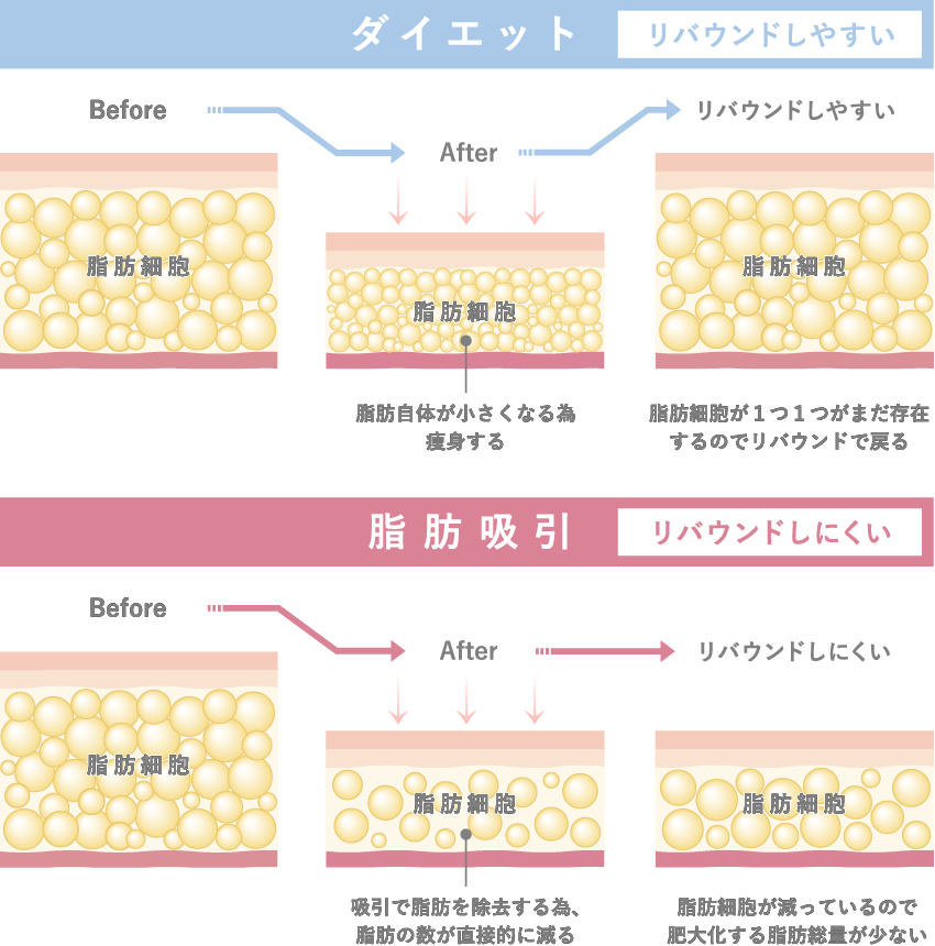 リバウンドしにくい原理イラスト