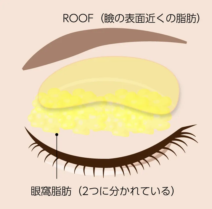 瞼の脂肪の構造図