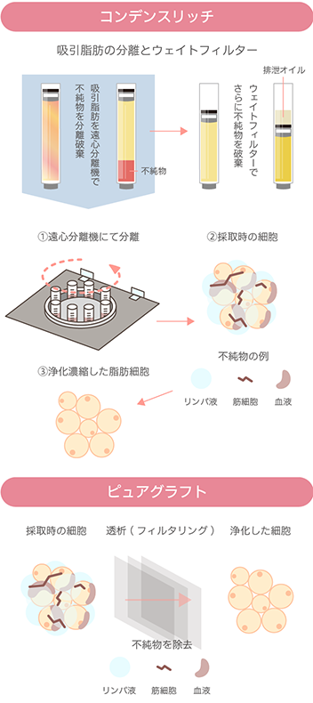 コンデンスリッチとピュアグラフトの説明
