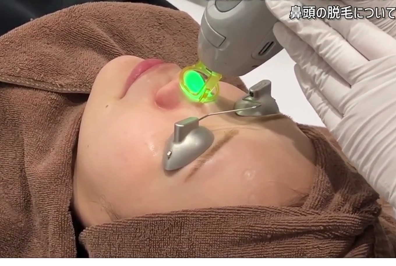 鼻脱毛イメージ