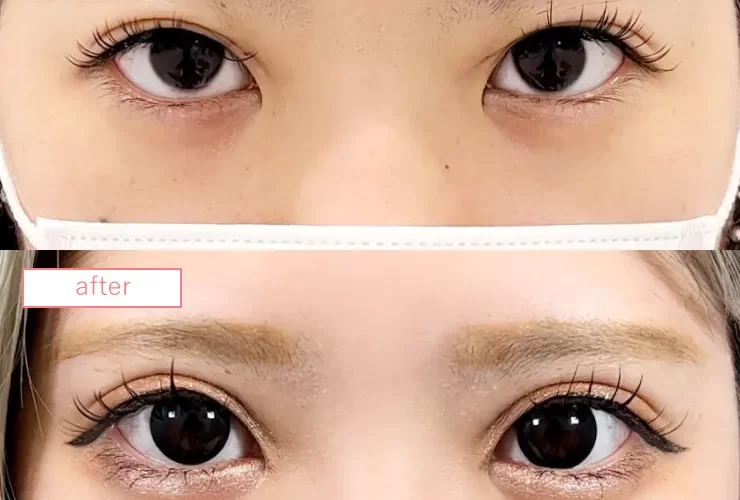 二重埋没法修正No20230510-04